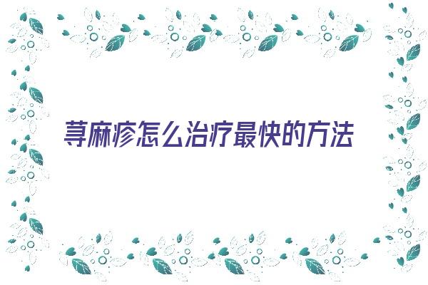 荨麻疹怎么治疗最快的方法视频(荨麻疹快速消退方法)